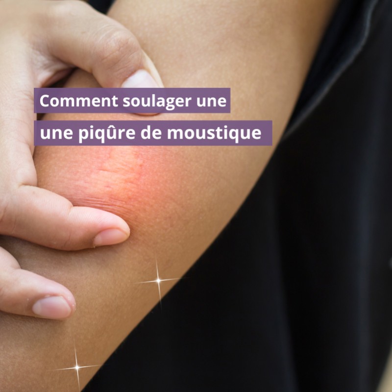 Comment soulager une piqûre de moustique 